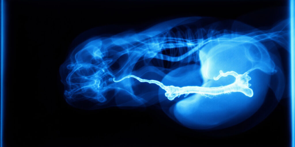 Radiografie veterinară obiect străin în stomac la câine